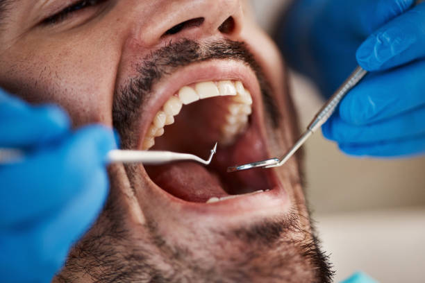 Best Emergency Root Canal Treatment in Mount Pulaski, IL